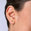TOPO BALIN 3MM